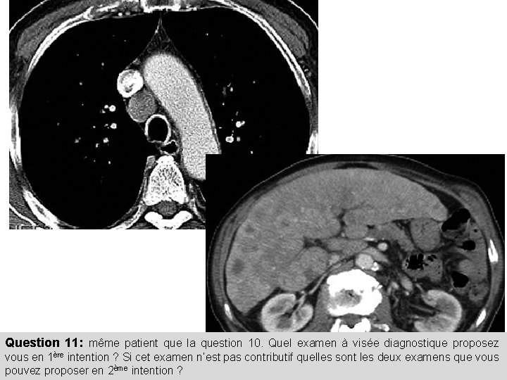 Question 11: même patient que la question 10. Quel examen à visée diagnostique proposez