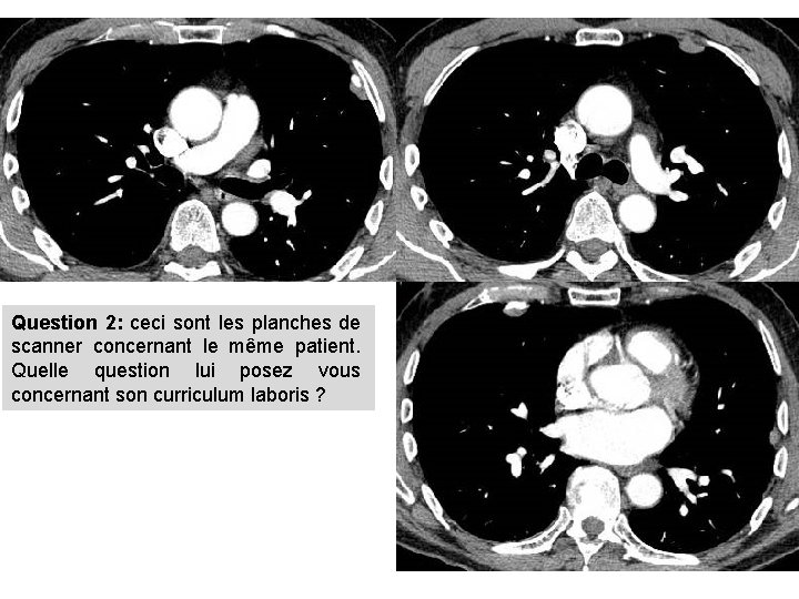 Question 2: ceci sont les planches de scanner concernant le même patient. Quelle question