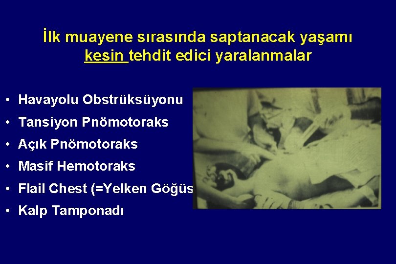 İlk muayene sırasında saptanacak yaşamı kesin tehdit edici yaralanmalar • Havayolu Obstrüksüyonu • Tansiyon İlk muayene sırasında saptanacak yaşamı kesin tehdit edici yaralanmalar • Havayolu Obstrüksüyonu • Tansiyon