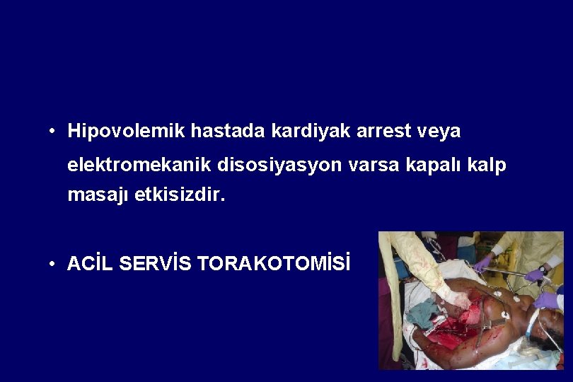  • Hipovolemik hastada kardiyak arrest veya elektromekanik disosiyasyon varsa kapalı kalp masajı etkisizdir.