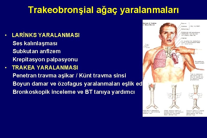 Trakeobronşial ağaç yaralanmaları • LARİNKS YARALANMASI Ses kalınlaşması Subkutan anfizem Krepitasyon palpasyonu • TRAKEA