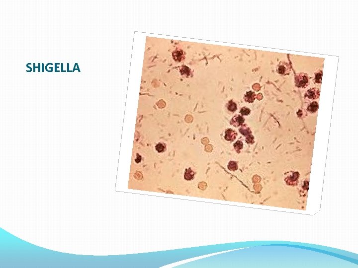 SHIGELLA 