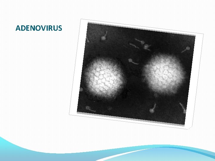 ADENOVIRUS 