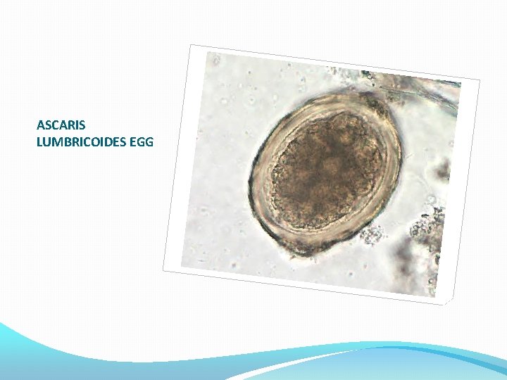 ASCARIS LUMBRICOIDES EGG 