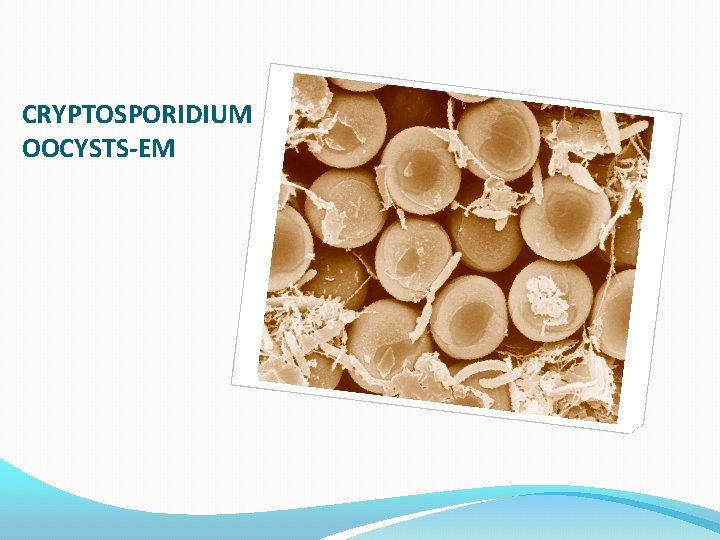 CRYPTOSPORIDIUM OOCYSTS-EM 