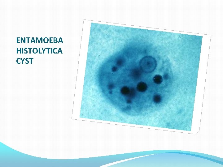 ENTAMOEBA HISTOLYTICA CYST 