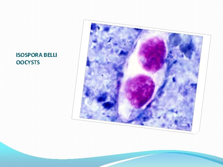 ISOSPORA BELLI OOCYSTS 