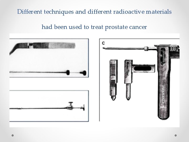 Different techniques and different radioactive materials had been used to treat prostate cancer 