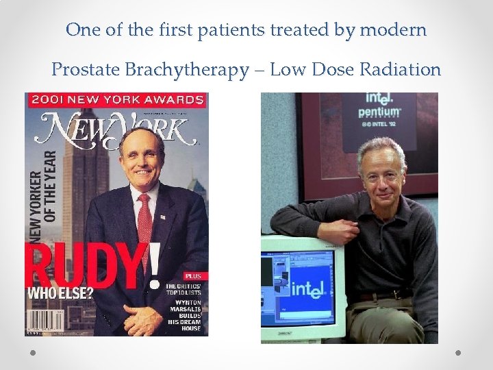 One of the first patients treated by modern Prostate Brachytherapy – Low Dose Radiation