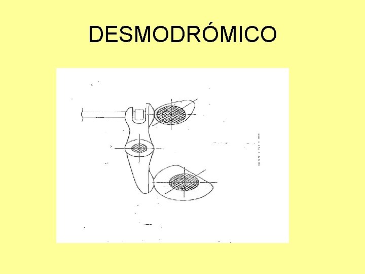 DESMODRÓMICO 