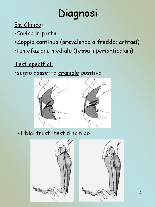 Diagnosi Es. Clinico: • Carico in punta • Zoppia continua (prevalenza a freddo: artrosi)