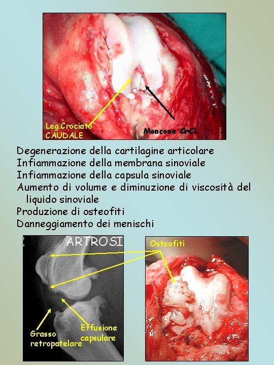 Leg. Crociato CAUDALE Moncone Cr. CL Degenerazione della cartilagine articolare Infiammazione della membrana sinoviale