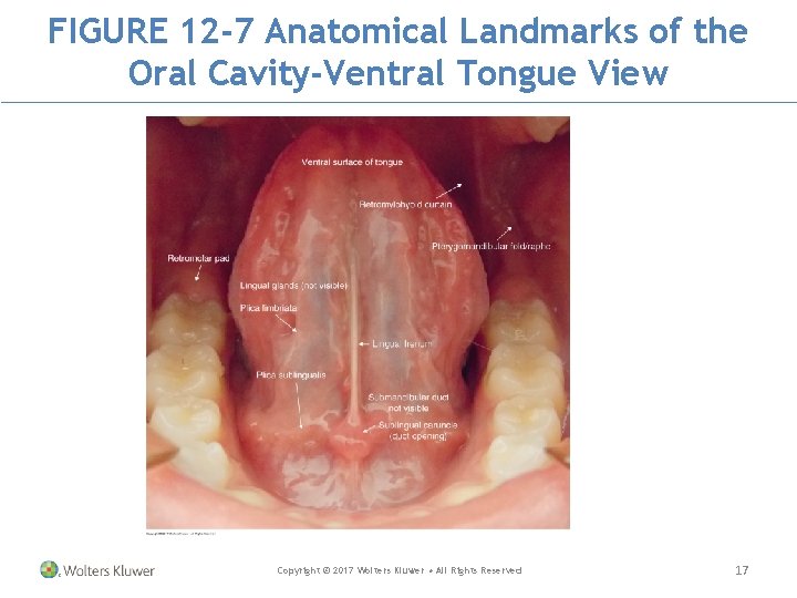 FIGURE 12 -7 Anatomical Landmarks of the Oral Cavity-Ventral Tongue View Copyright © 2017