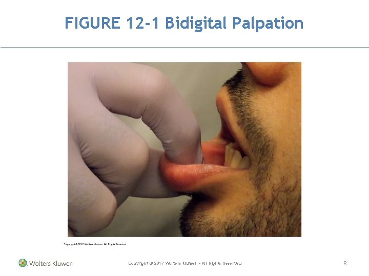 FIGURE 12 -1 Bidigital Palpation Copyright © 2017 Wolters Kluwer • All Rights Reserved