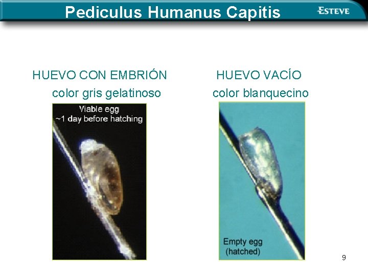 Pediculus Humanus Capitis HUEVO CON EMBRIÓN color gris gelatinoso HUEVO VACÍO color blanquecino 9