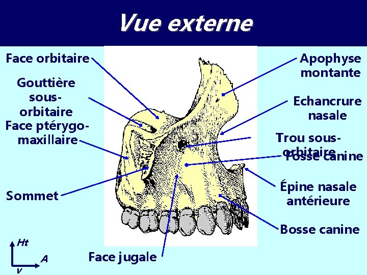 Vue externe Face orbitaire Gouttière sousorbitaire Face ptérygomaxillaire Echancrure nasale Trou sousorbitaire Fosse canine