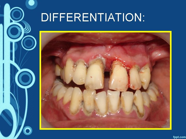 DIFFERENTIATION: 