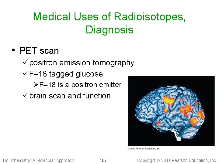 Medical Uses of Radioisotopes, Diagnosis • PET scan ü positron emission tomography ü F–