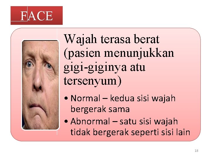 FACE Wajah terasa berat (pasien menunjukkan gigi-giginya atu tersenyum) • Normal – kedua sisi