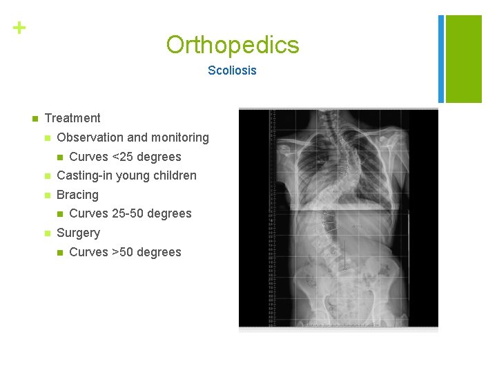 + Orthopedics Scoliosis n Treatment n Observation and monitoring n Curves <25 degrees n