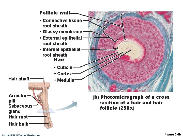 Follicle wall • Connective tissue root sheath • Glassy membrane • External epithelial root