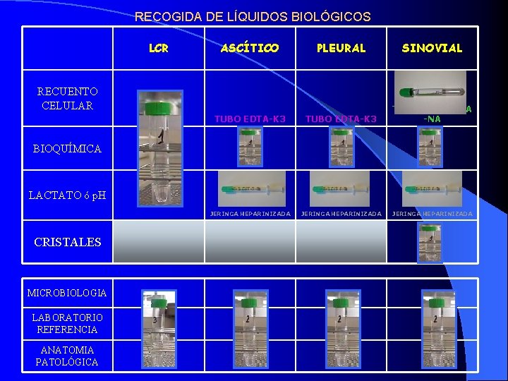 RECOGIDA DE LÍQUIDOS BIOLÓGICOS LCR ASCÍTICO PLEURAL SINOVIAL TUBO EDTA-K 3 TUBO HEPARINA -NA