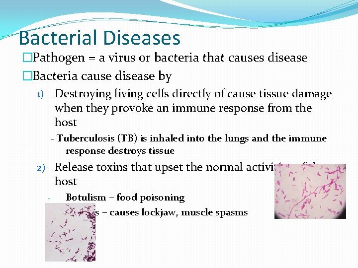 Bacterial Diseases �Pathogen = a virus or bacteria that causes disease �Bacteria cause disease