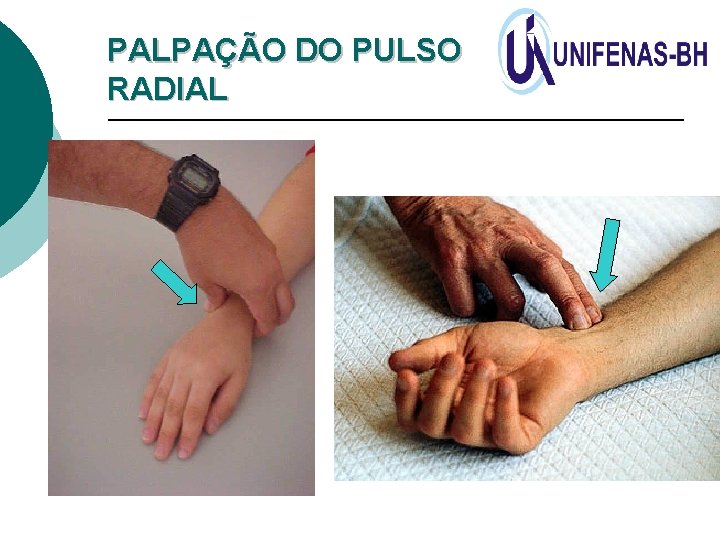 PALPAÇÃO DO PULSO RADIAL 