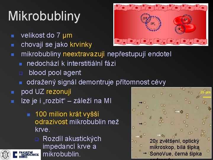 Mikrobubliny n n n velikost do 7 µm chovají se jako krvinky mikrobubliny neextravazují