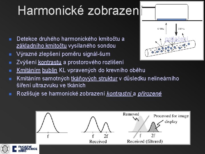 Harmonické zobrazení n n n Detekce druhého harmonického kmitočtu a potlačení základního kmitočtu vysílaného