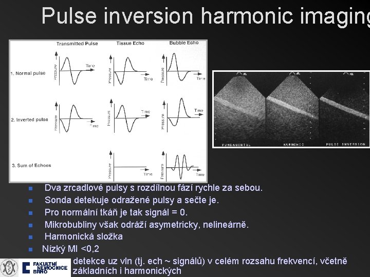 Pulse inversion harmonic imaging n n n n Dva zrcadlové pulsy s rozdílnou fází