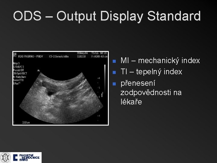 ODS – Output Display Standard n n n MI – mechanický index TI –