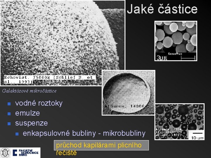 Jaké částice Galaktózové mikročástice n n n vodné roztoky emulze suspenze n enkapsulovné bubliny