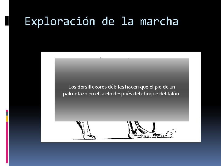 Exploración de la marcha Los dorsiflexores débiles hacen que el pie de un palmetazo