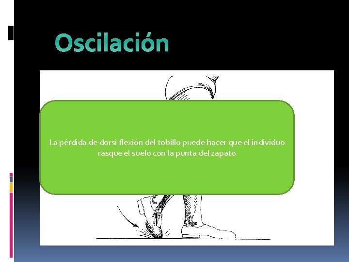 Oscilación La pérdida de dorsi flexión del tobillo puede hacer que el individuo rasque