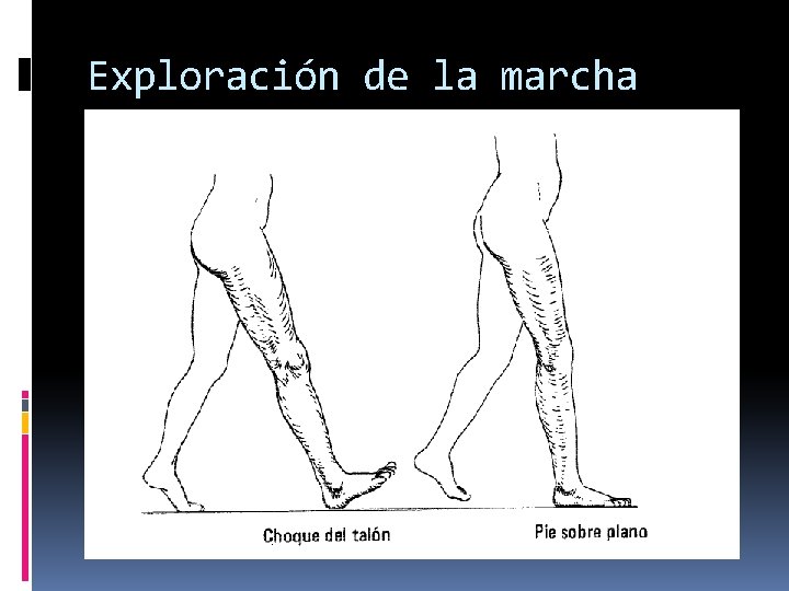 Exploración de la marcha 