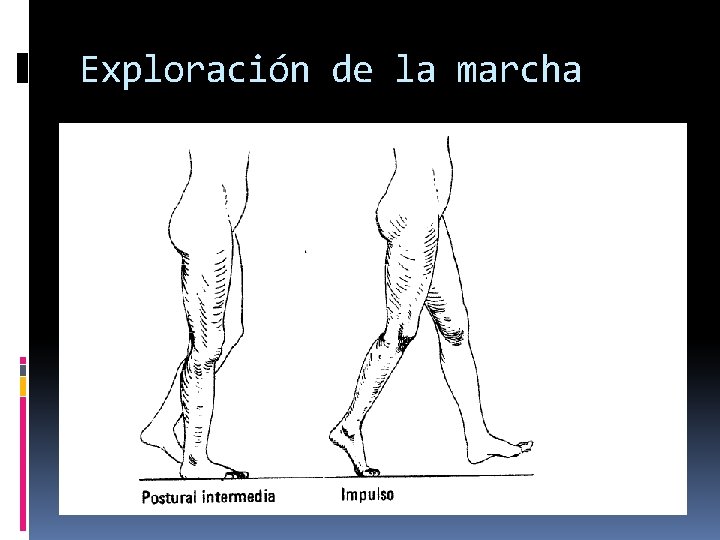 Exploración de la marcha 