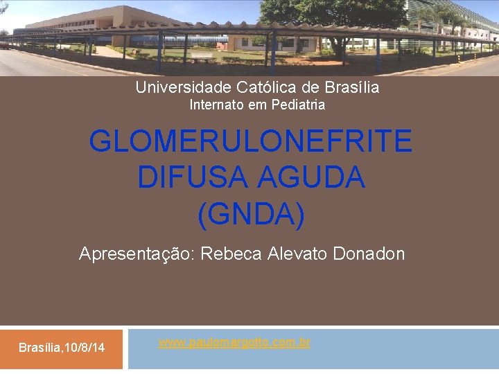 Universidade Católica de Brasília Internato em Pediatria GLOMERULONEFRITE DIFUSA AGUDA (GNDA) Apresentação: Rebeca Alevato