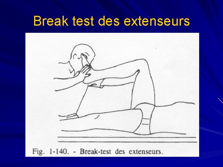 Break test des extenseurs 