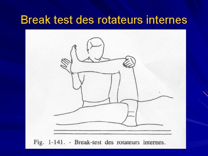 Break test des rotateurs internes 