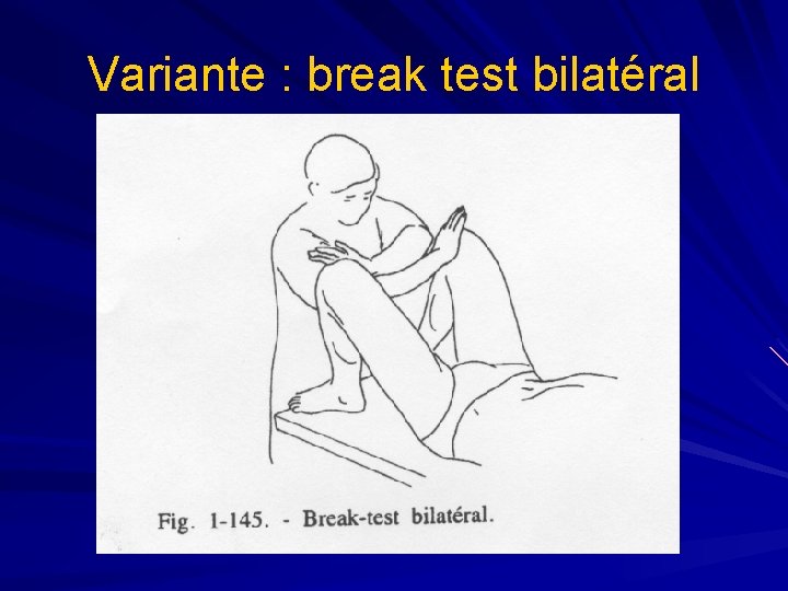 Variante : break test bilatéral 