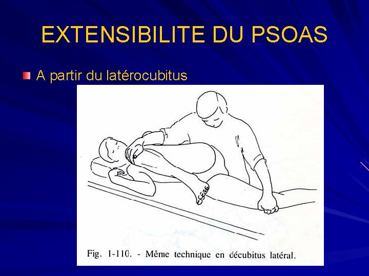 EXTENSIBILITE DU PSOAS A partir du latérocubitus 
