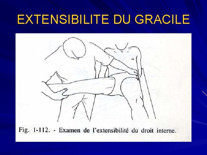 EXTENSIBILITE DU GRACILE 