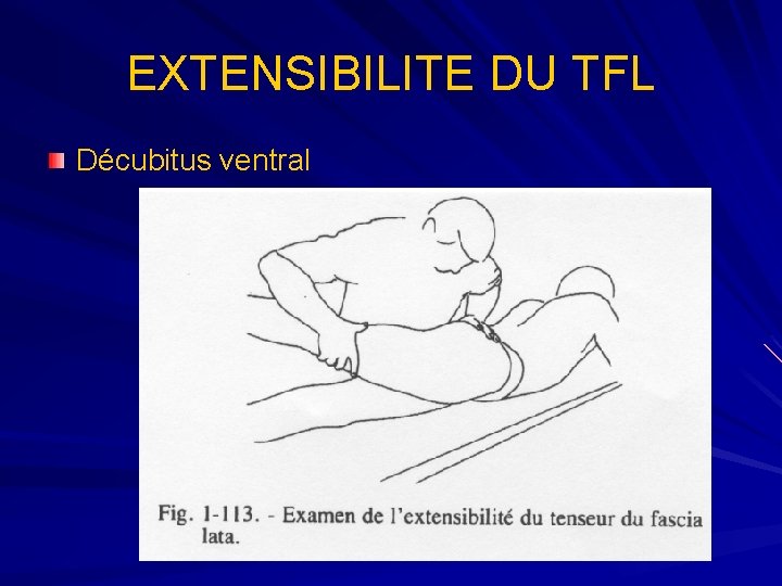 EXTENSIBILITE DU TFL Décubitus ventral 
