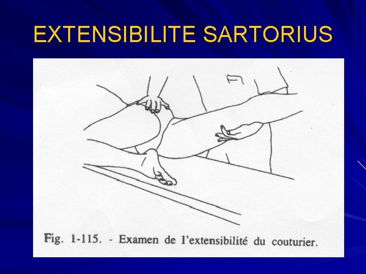 EXTENSIBILITE SARTORIUS 