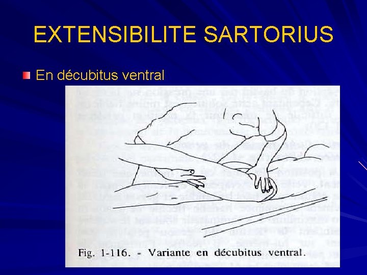 EXTENSIBILITE SARTORIUS En décubitus ventral 