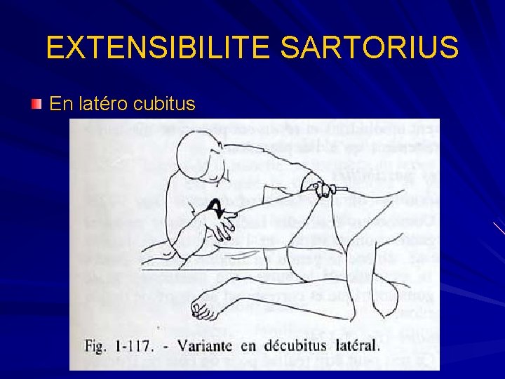 EXTENSIBILITE SARTORIUS En latéro cubitus 