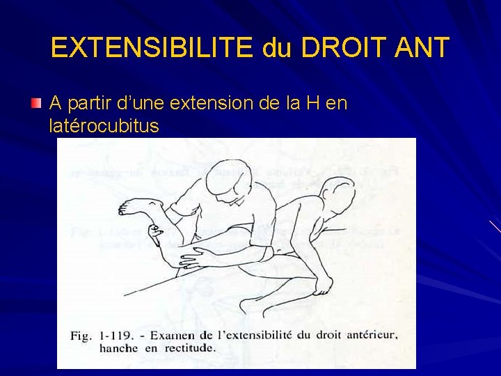 EXTENSIBILITE du DROIT ANT A partir d’une extension de la H en latérocubitus 