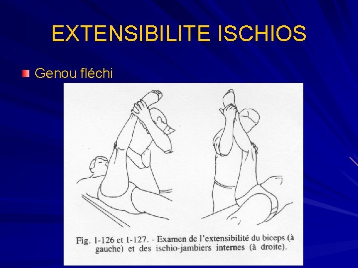 EXTENSIBILITE ISCHIOS Genou fléchi 