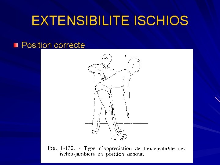 EXTENSIBILITE ISCHIOS Position correcte 